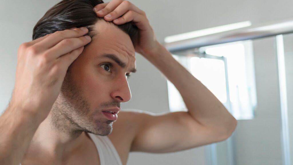 Queda De Cabelo Masculina Quais S O As Causas E Como Tratar Pharmacia