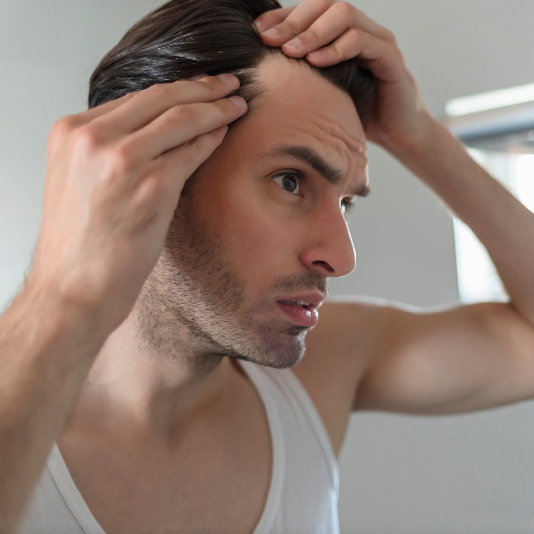 queda de cabelo masculino - veja causas e como tratar-